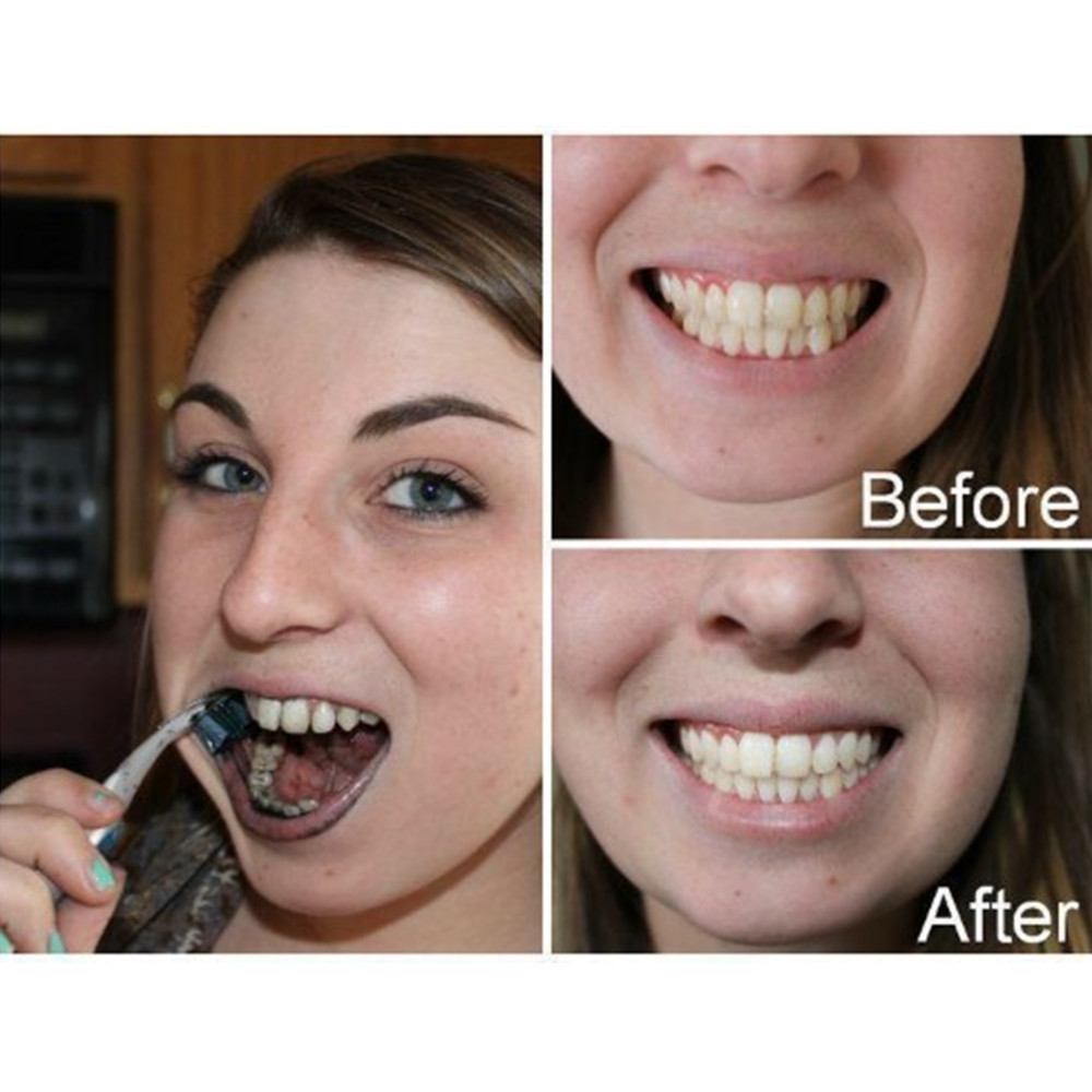 الخيزران الفحم الأسنان الأسنان - مراجعة Teeth Whitening Quotes وسعره