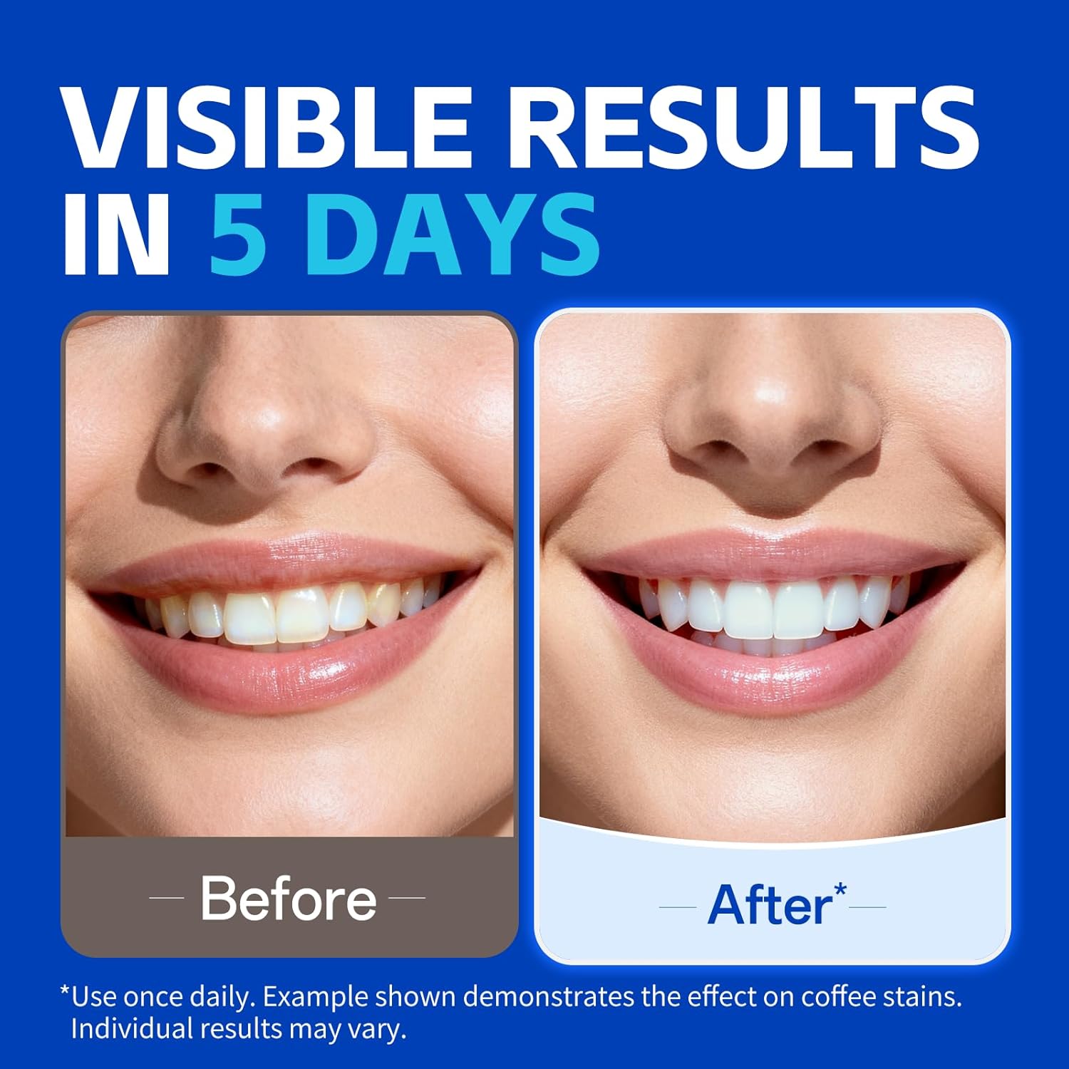 شرائط تبييض الأسنان (1/7 زوج)  - مراجعة Teeth Whitening Strips Permanent وسعره