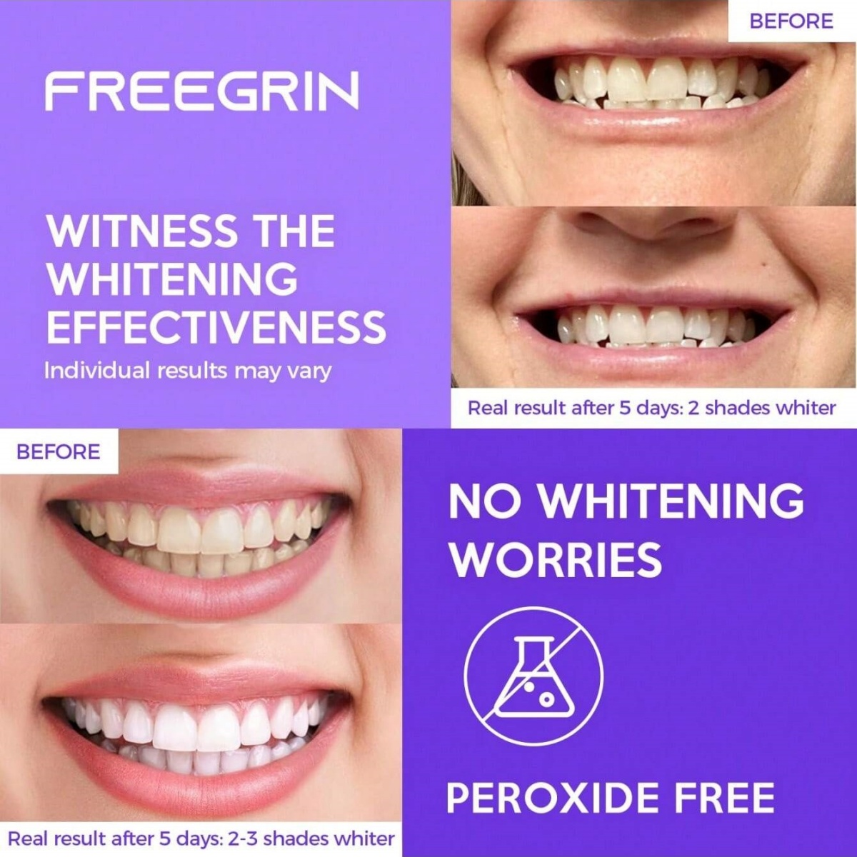 ديلوكس تبييض الأسنان ملصقات 7/ - مراجعة Teeth Whitening Strips Permanent وسعره