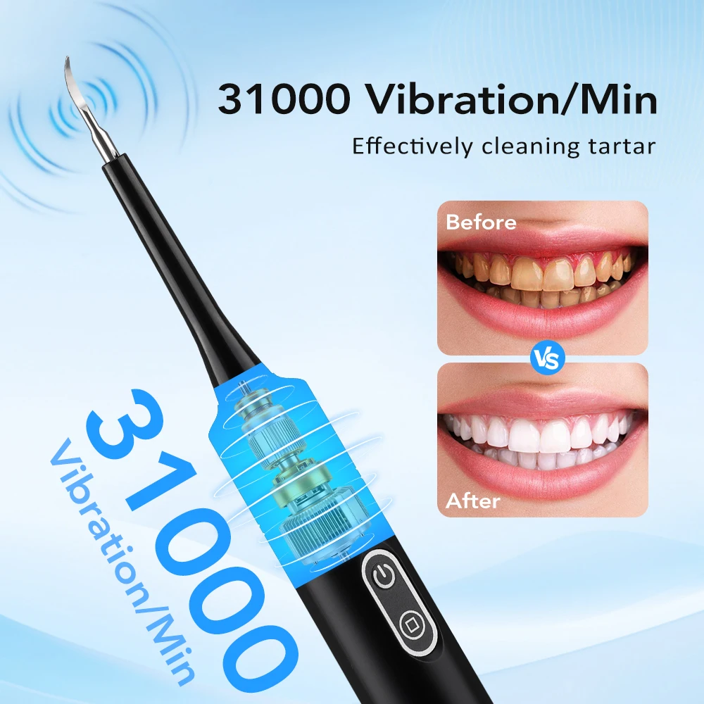 جهاز تنظيف الأسنان بالاهتزاز ا - مراجعة Whitening Teeth Dentist وسعره